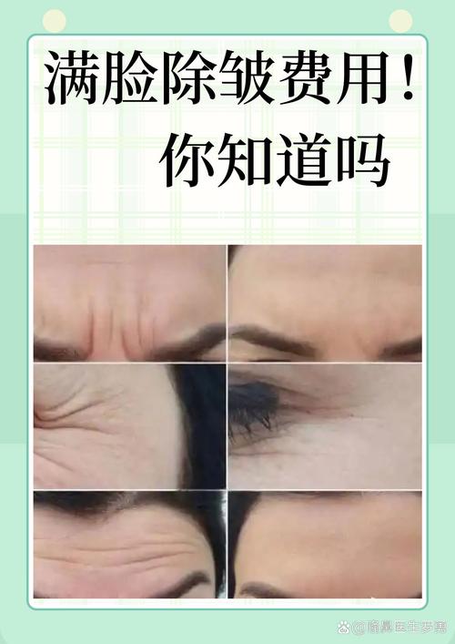 什么除皱纹