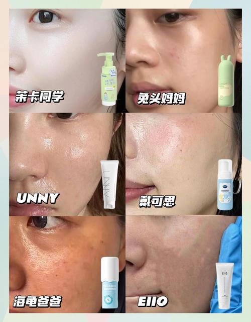 洗面奶过敏怎么