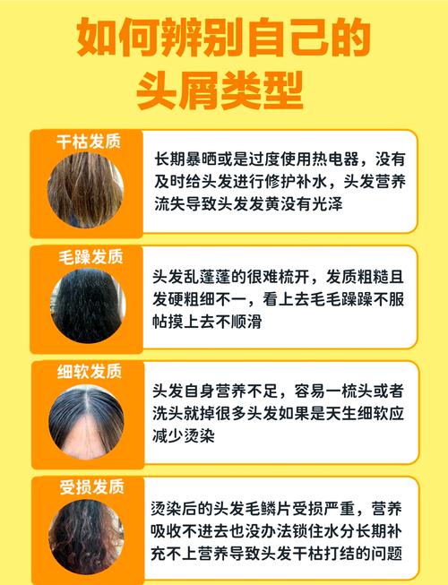 头发为什么干枯毛躁