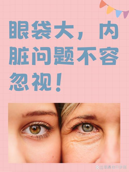 为什么眼袋减肥