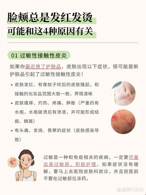 面部发红是什么病
