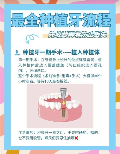 什么情况需要种植牙