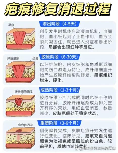 什么是增生期
