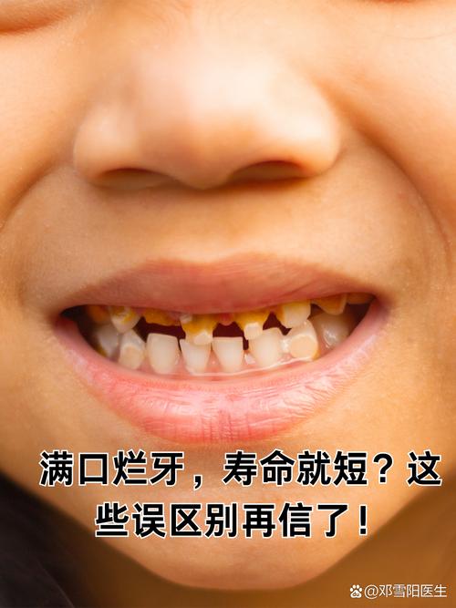 牙都有什么病