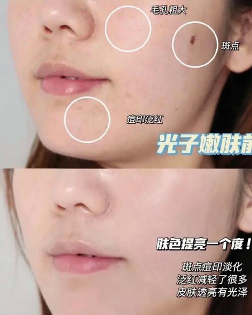 嫩肤是什么