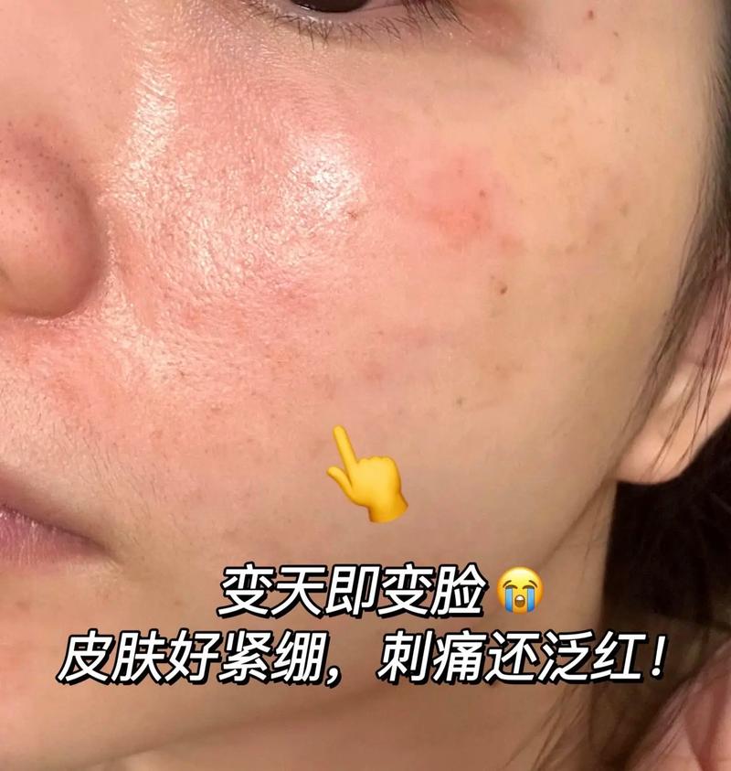感觉敏什么