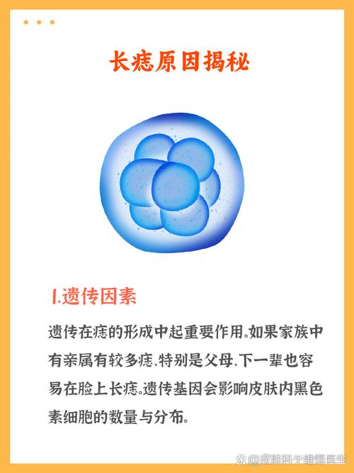 长很多痣是什么原因
