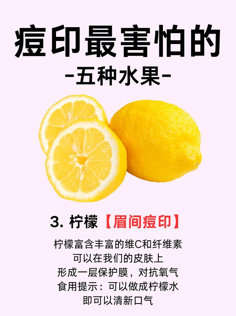 吃什么能淡化痘印