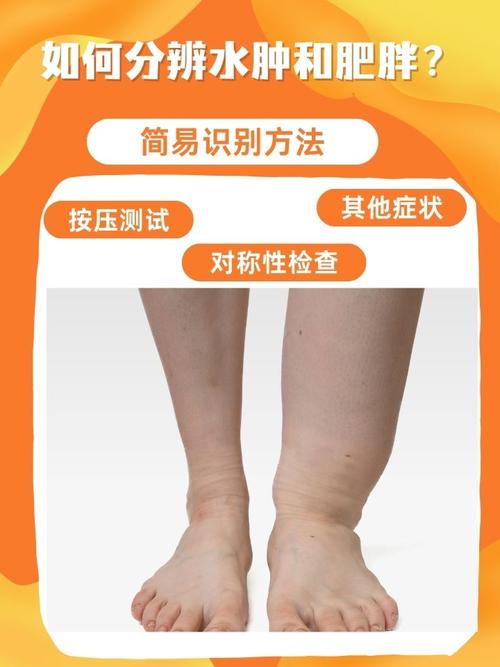 小腿变粗是什么原因