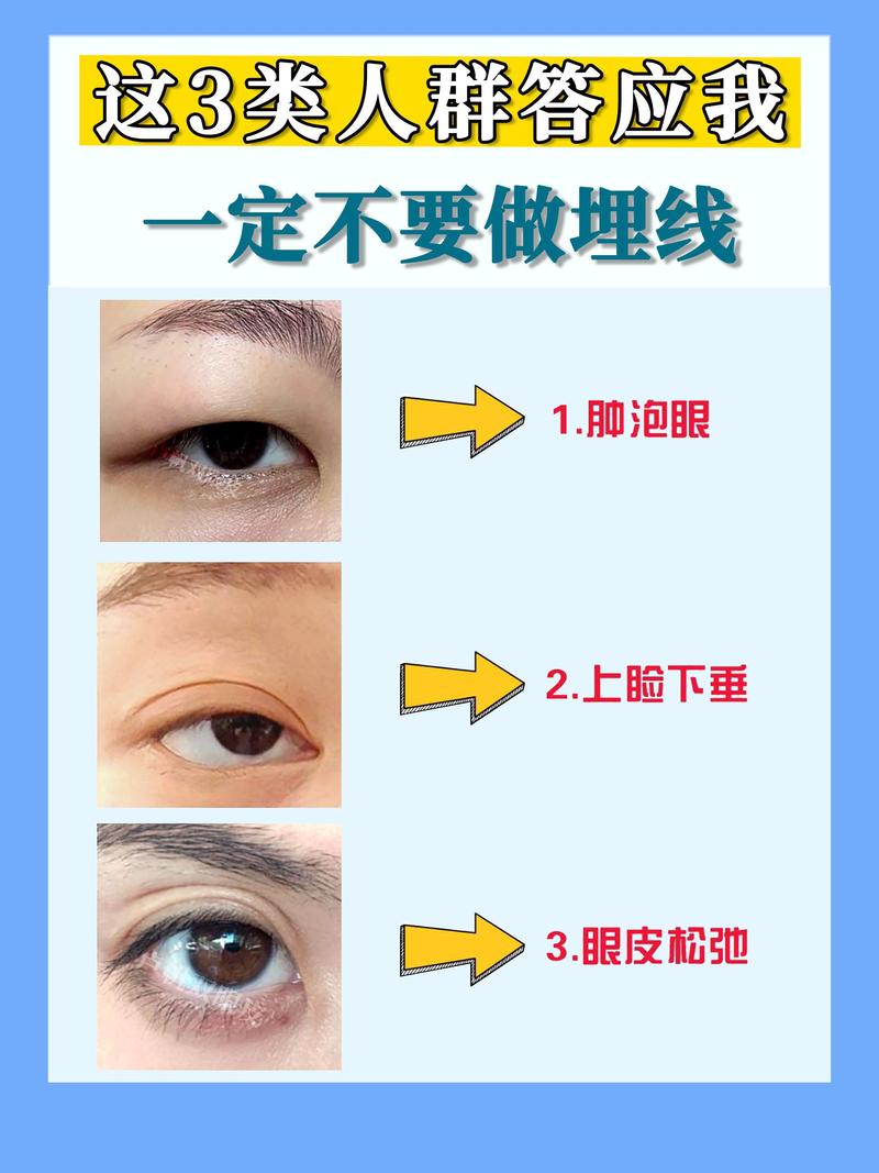 眼皮松弛是什么原因