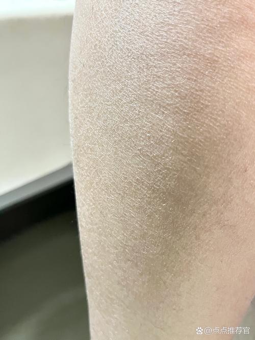 身上为什么会起皮