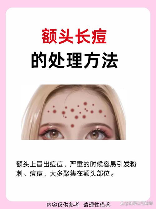 什么皮肤容易长痘痘