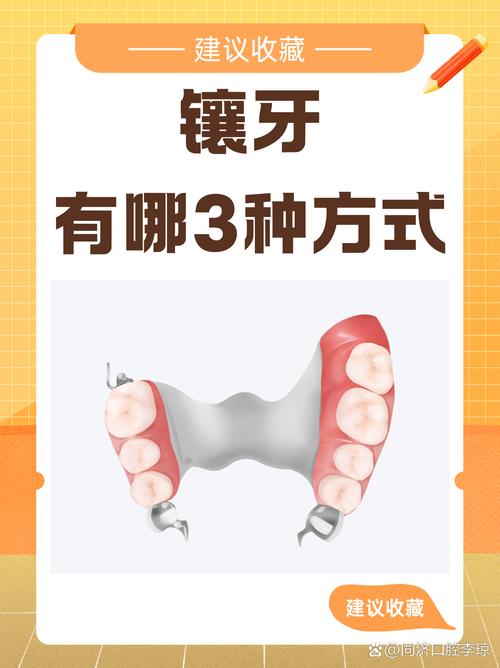 镶牙有什么坏处