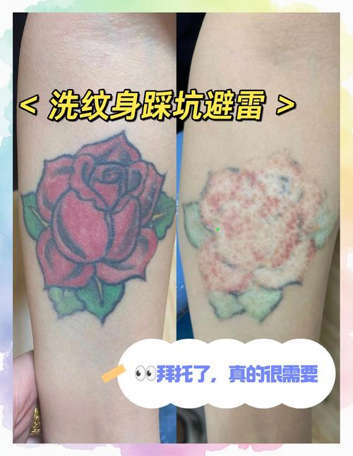 为什么洗纹身
