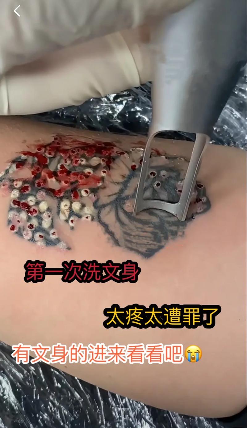 为什么洗纹身