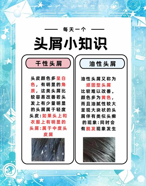 为什么头皮屑这么多