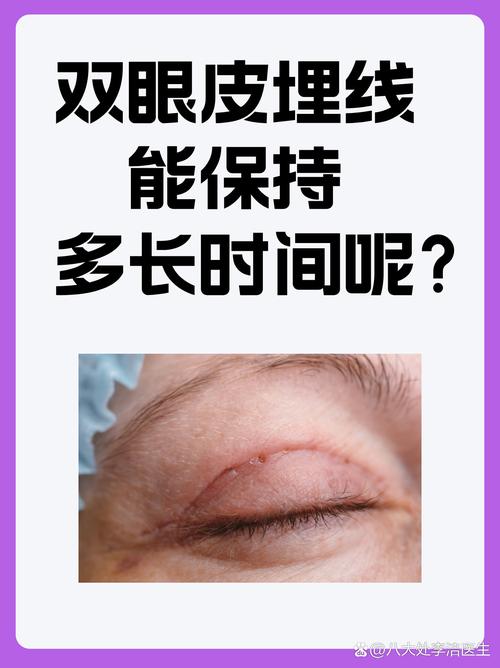 埋线双眼皮能吃什么