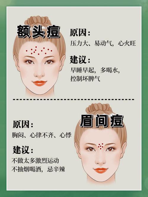 为什么脸颊两侧长痘