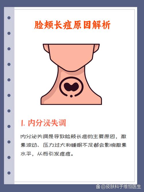 为什么脸颊两侧长痘