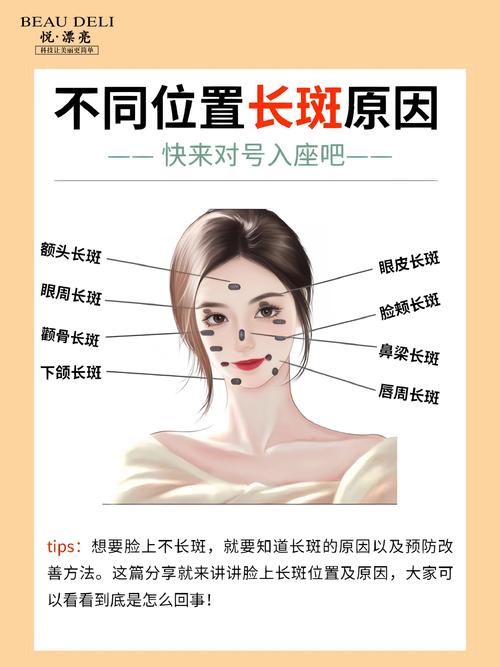脸上长色斑什么原因