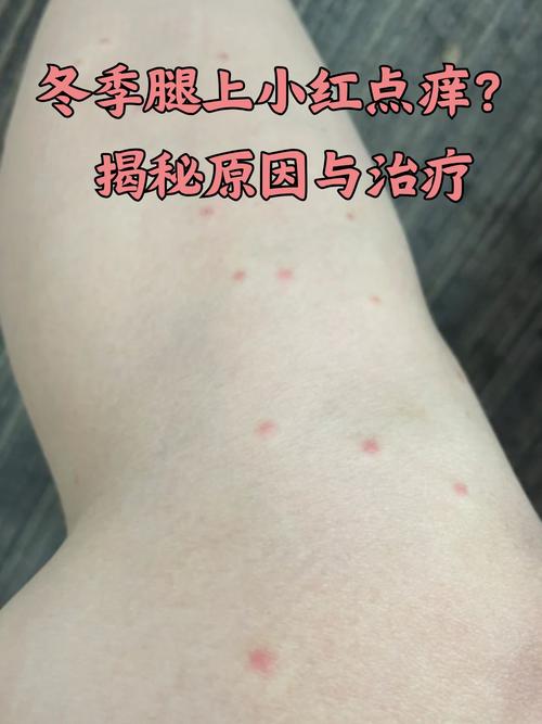 身上刺痒是什么原因
