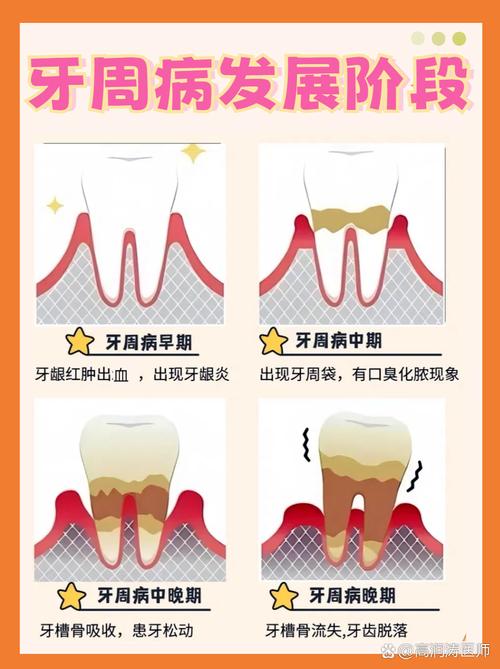 牙龈松动是什么原因