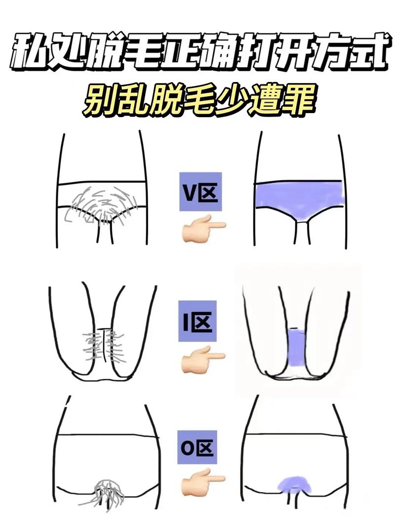 脱毛有什么副作用吗