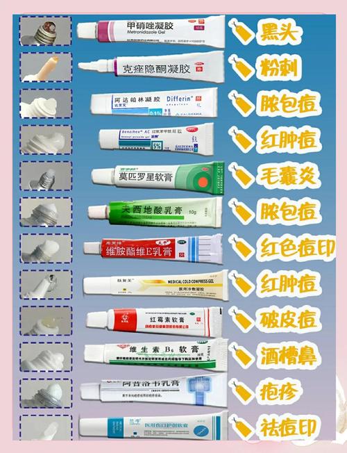 治疗痤疮用什么药膏
