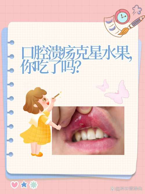 嘴巴溃疡吃什么水果