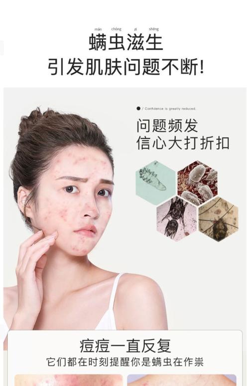 祛螨虫洗面奶怎么用