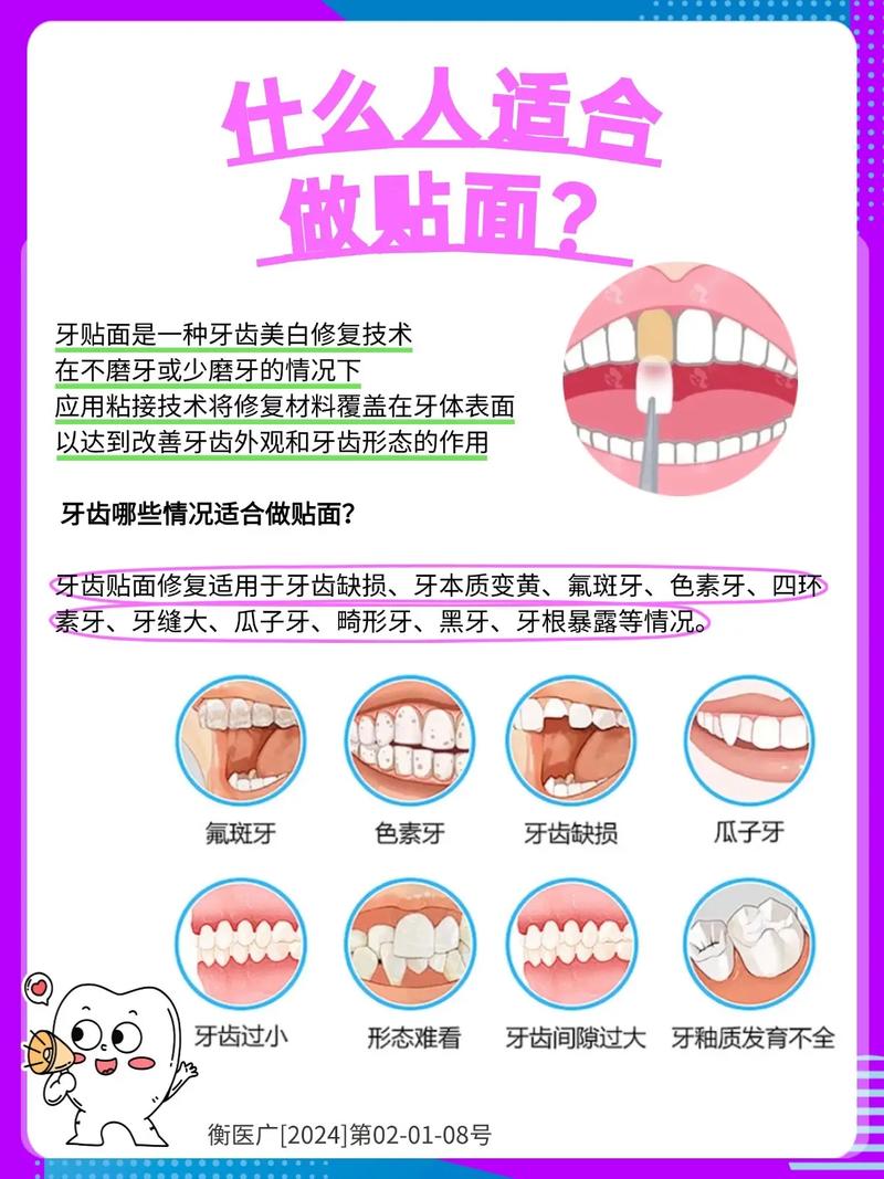 牙齿贴片什么意思