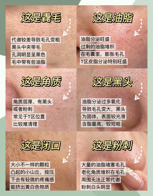 什么缩小毛孔
