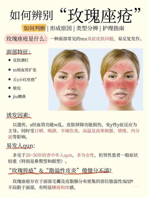 什么是座疮