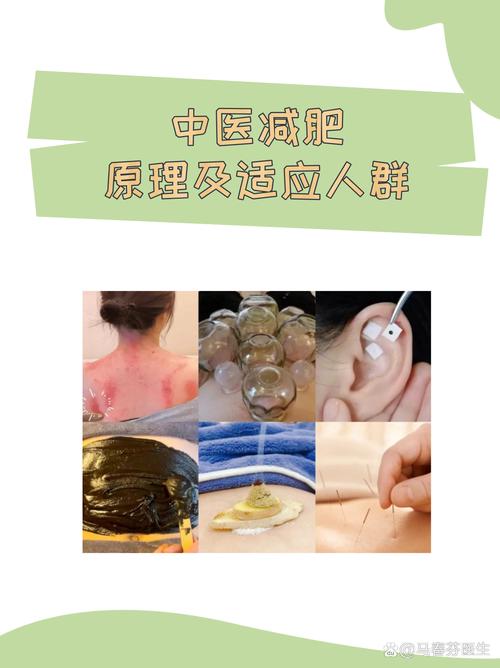 什么药能代替拔罐减肥