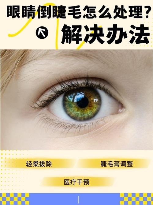 掉眼睫毛是什么原因