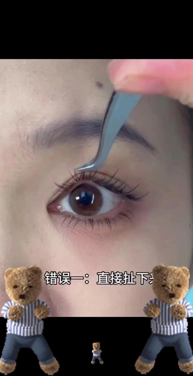 掉眼睫毛是什么原因