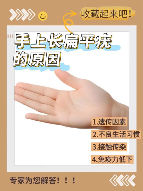 为什么会长扁平疣呢