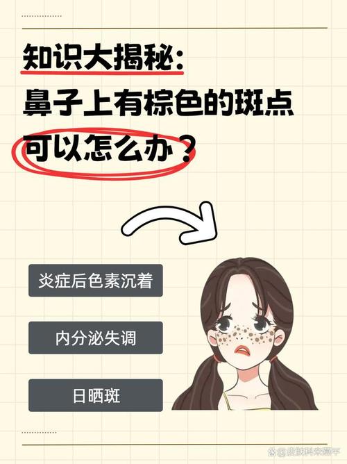 鼻梁长斑是什么原因