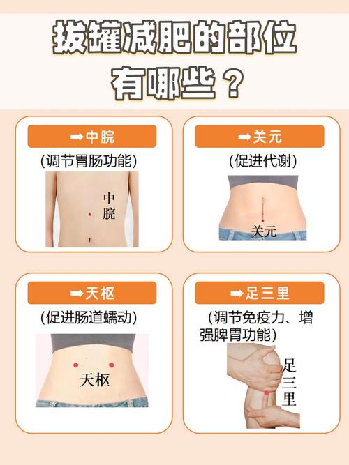 什么人不宜拔火罐减肥