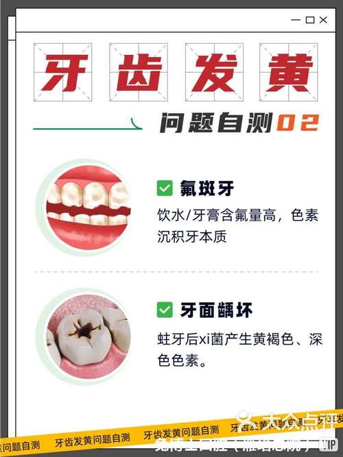 牙根黄是什么原因