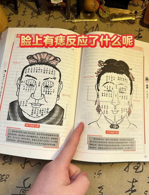 脸上长黑痣什么原因