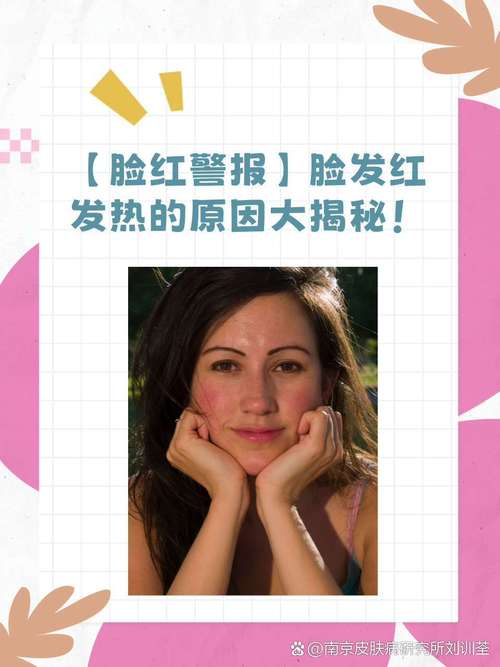 红脸蛋是什么原因