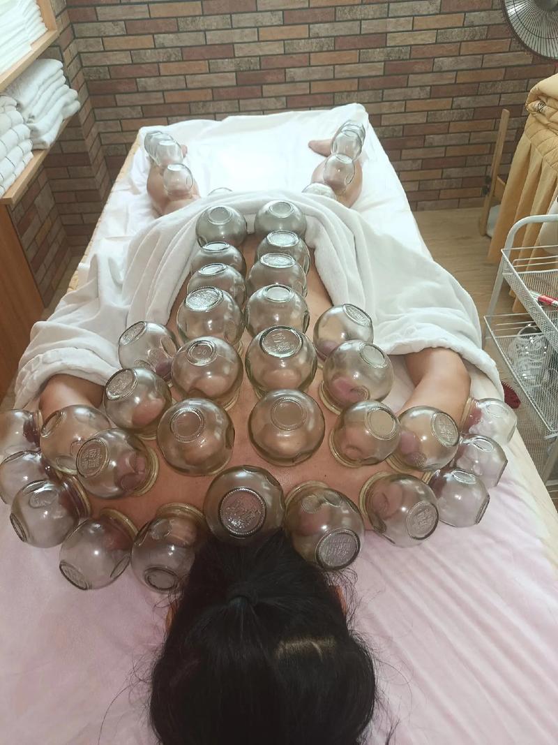 什么季节拔拔罐减肥好