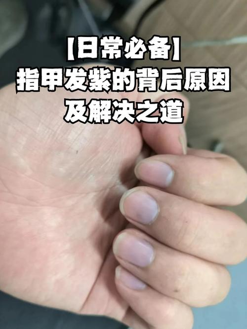指甲变色是什么原因