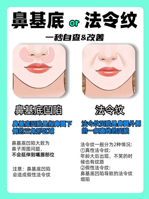 鼻沟是什么