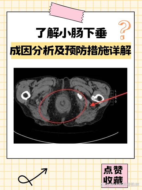 什么地下垂