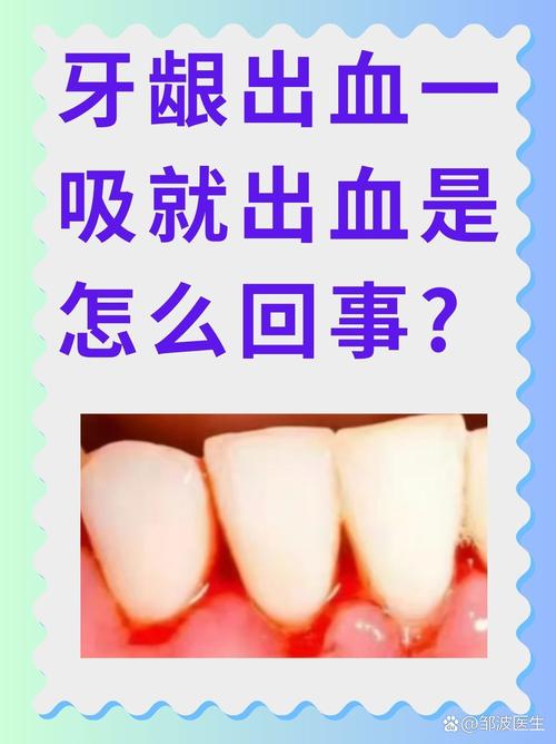 为什么牙龈一直出血