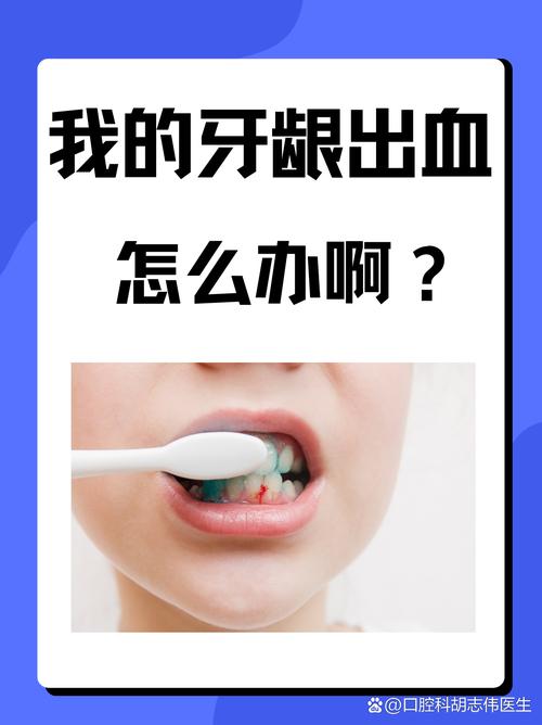 为什么牙龈一直出血