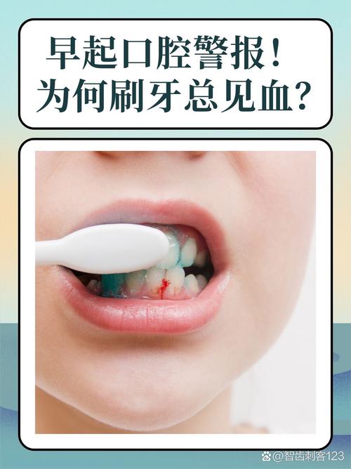 为什么牙龈一直出血