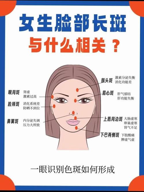 为什么脸上会长斑点